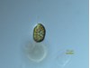 Photo of Heterosigma akashiwo